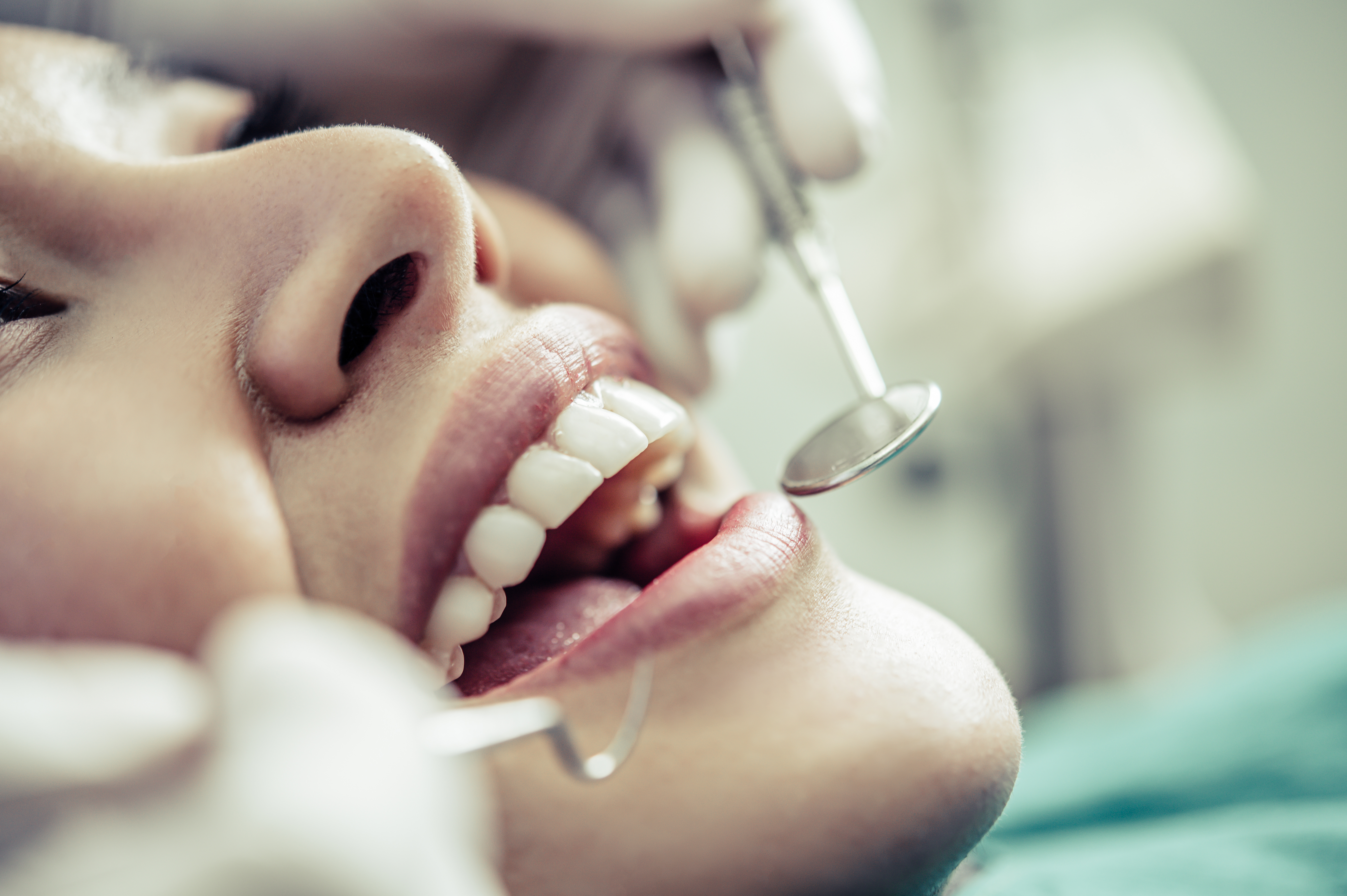 Dental instruments and shade guide