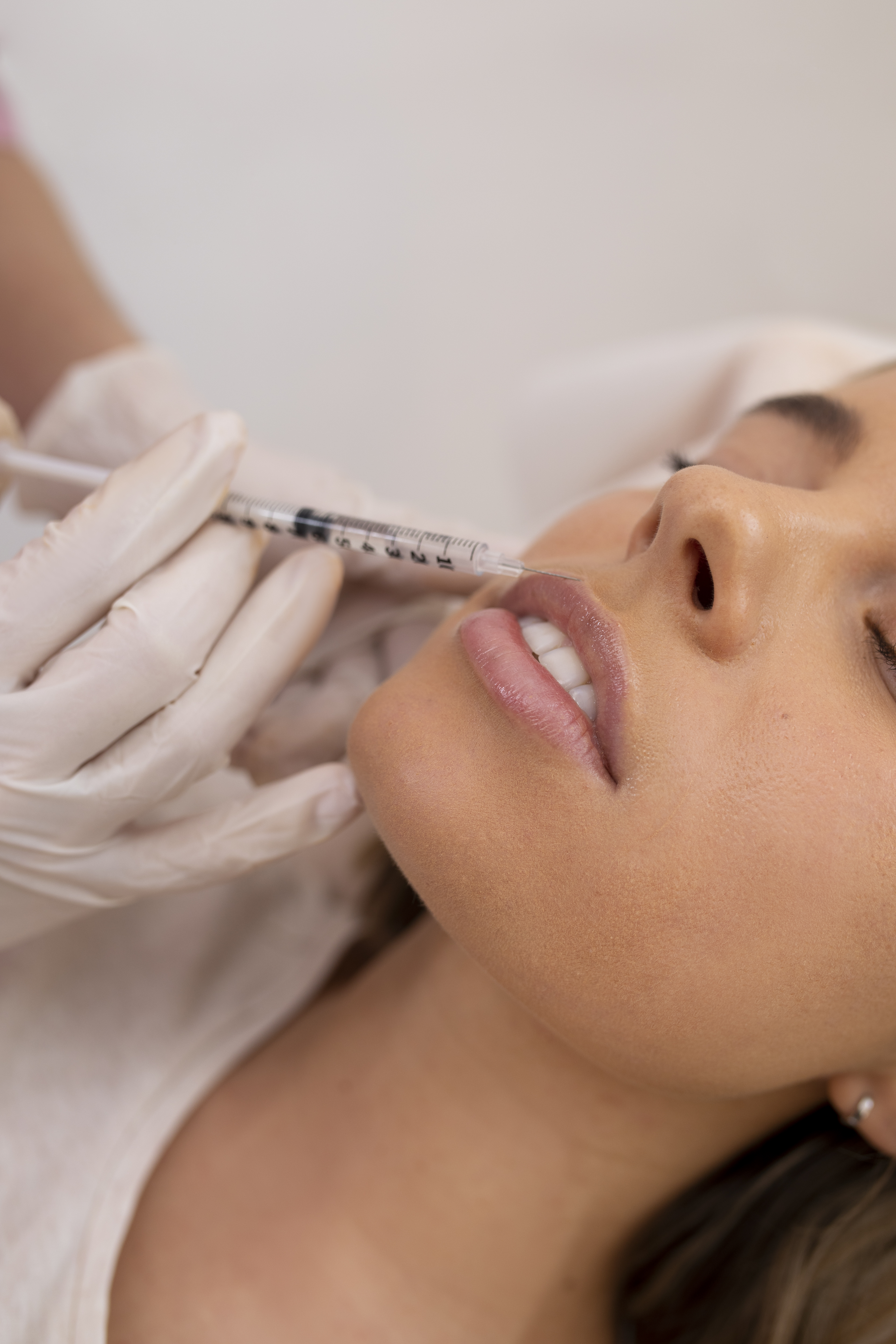 Syringe and vial for aesthetic fillers